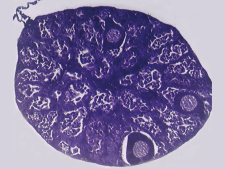 Atrazine Frog Testes